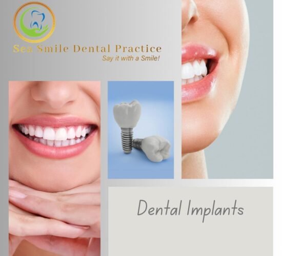 Dental Implants