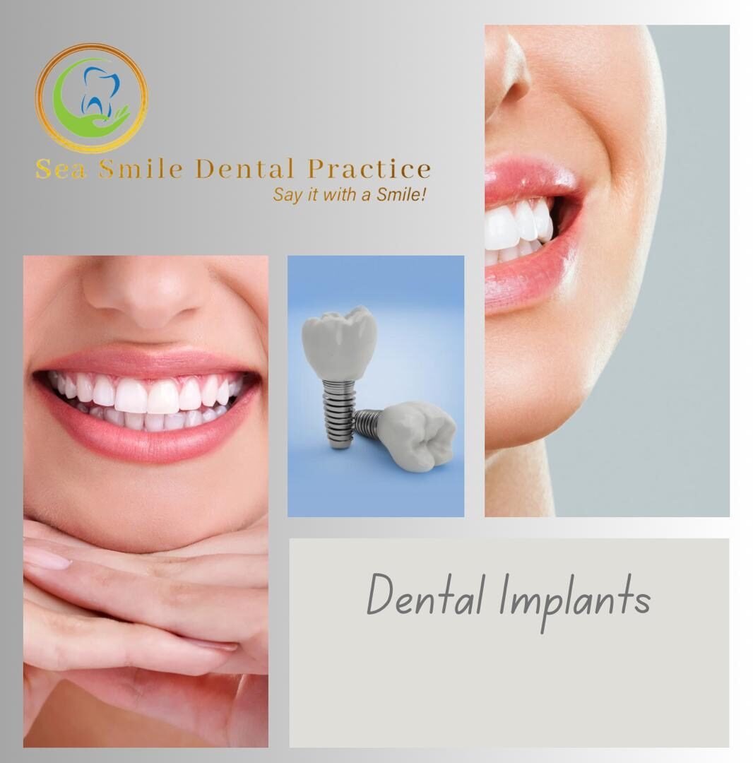 Dental Implants